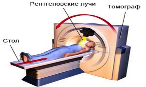 Направление лучей на рентгеновском компьютерном томографе